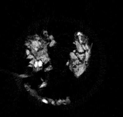Eredmények, MicroCT analízis kvalitatív eredményei Az I.