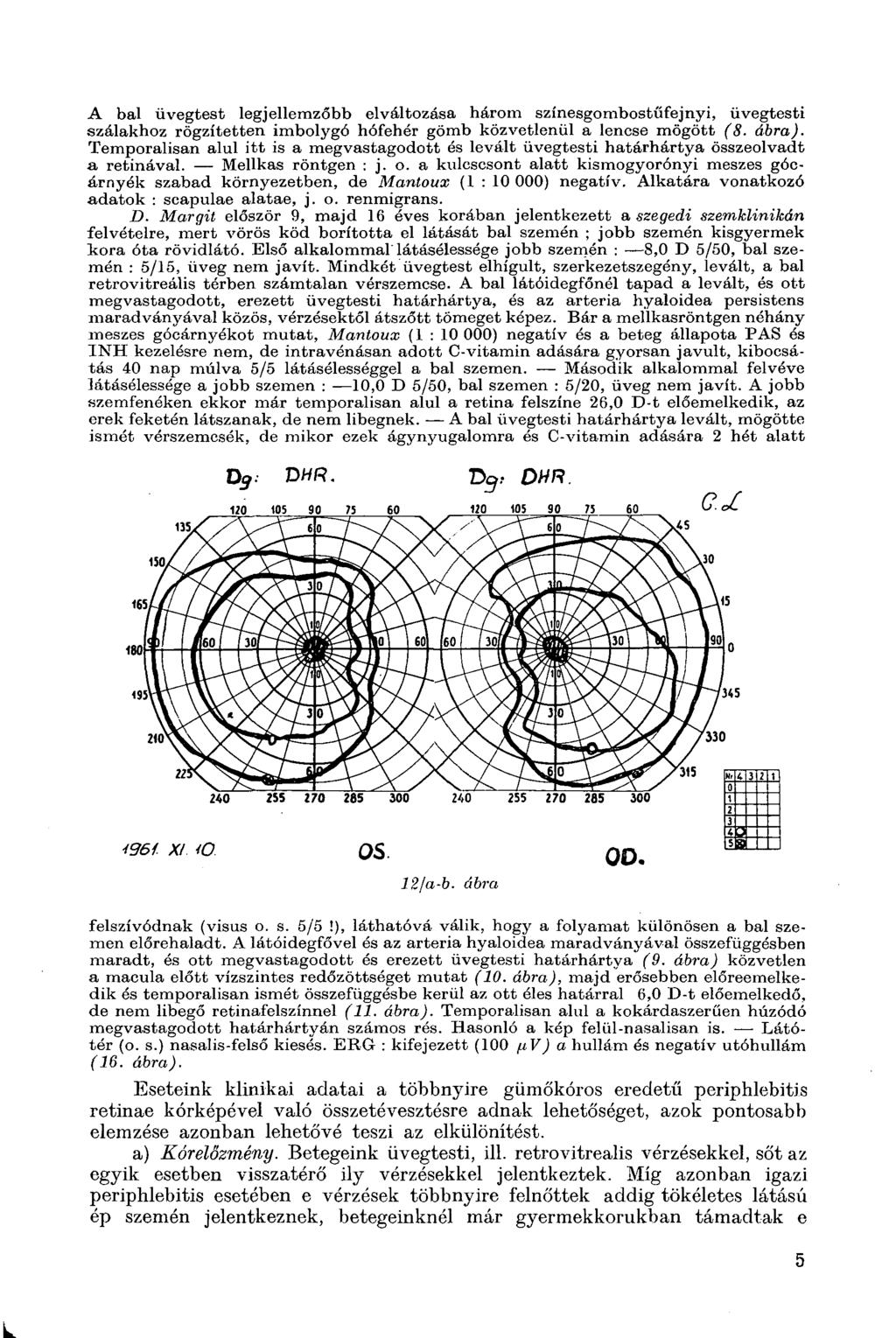 A bal üvegtest legjellemzőbb elváltozása három színesgombostűfejnyi, üvegtesti szálakhoz rögzítetten imbolygó hófehér gömb közvetlenül a lencse mögött (8. ábra).