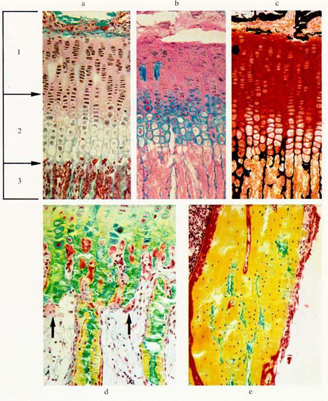 Az epiphysis