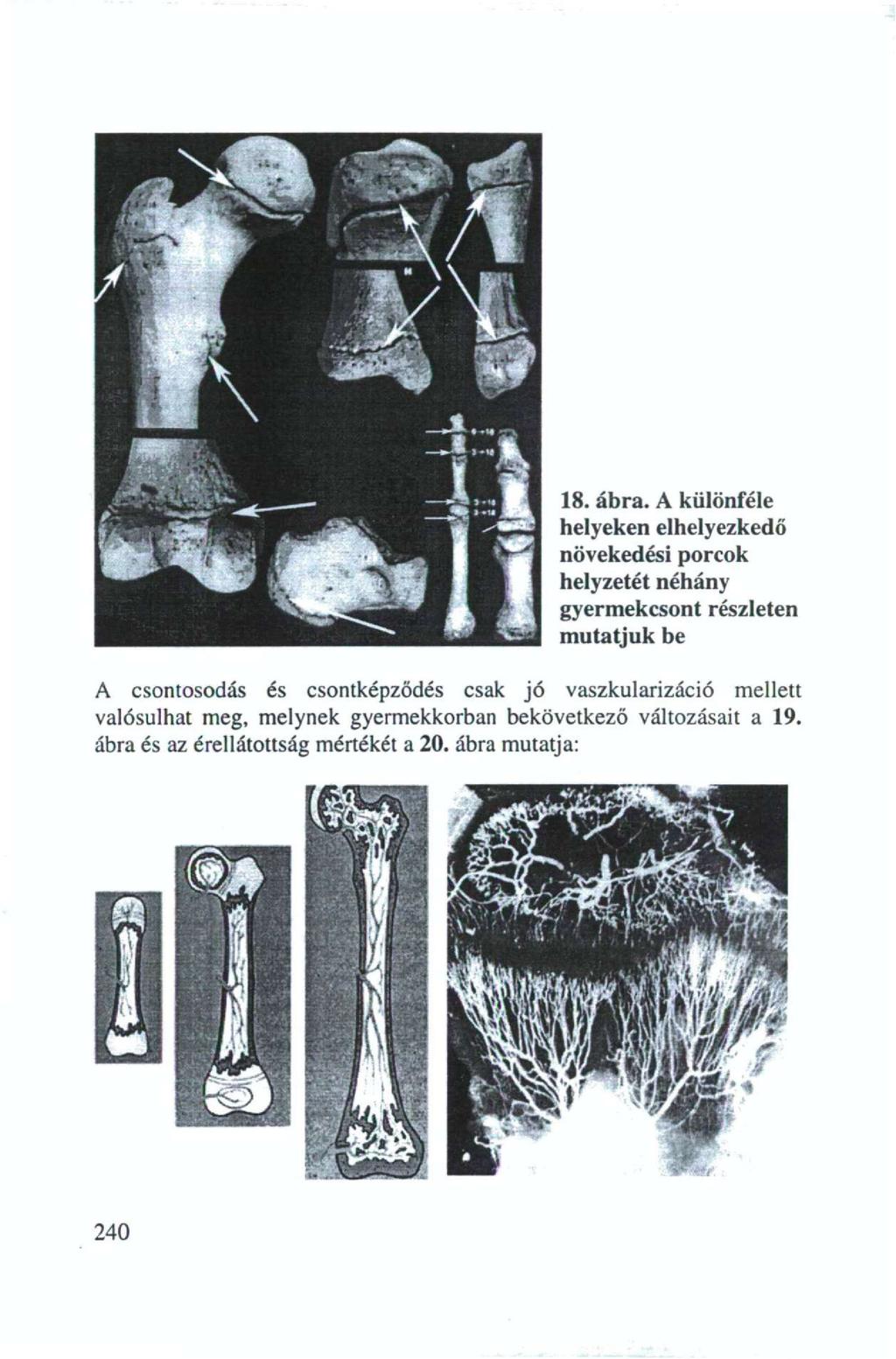 18. ábra.