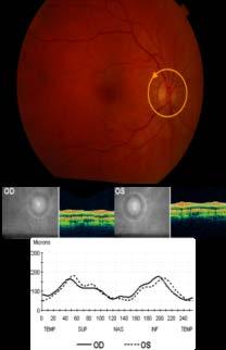 afferens reflex www.