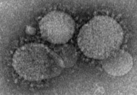 Middle East Respiratory Syndrome Coronavirus