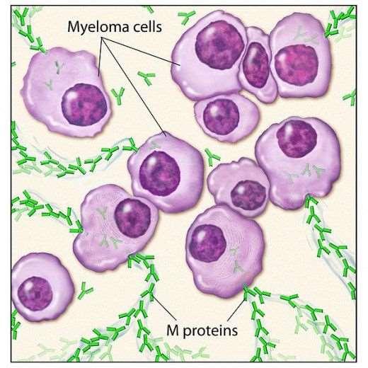 Patogenezis A hibásan hajtogatott fehérjék fiziologiás esetben lebomlanak. Az amyloid lerakódások el nem ágazódó fibrillumokból állnak, melyek béta lemez polipeptidláncokból épülnek fel.