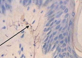 Szabad (csupasz) idegvégződés Vékony myelin hüvelyes (Aδ) vagy myelin hüvely nélküli (Schwann sejt borítású) axonok (C) Az axonvégződés membránjában receptor fehérjék