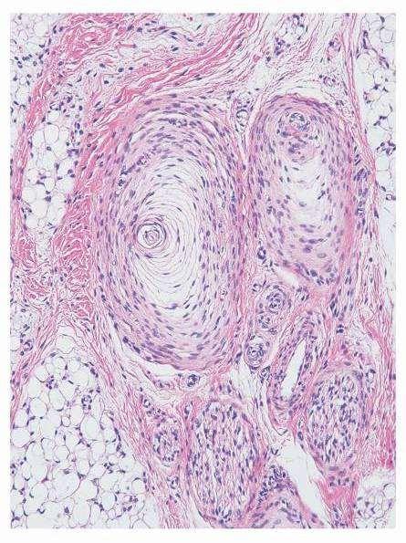 Vater-Pacini test Elasztikus rostokat tartalmazó kötőszövetes tokkal ellátott, (gyorsan adaptálódó) mechanoreceptor. Vibrációra érzékeny. 2-5 mm. Külső lamelláris tokból és belső hengerből áll.