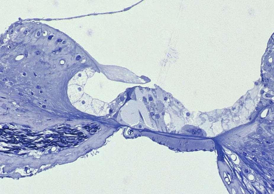 A Corti-szerv szövettani képe belső szőrsejt külső