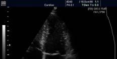 A transducer egyenletes sebességgel forog, és közben T időközönként A scan-t