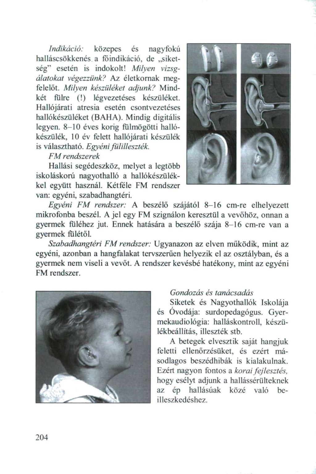 Indikáció: közepes és nagyfokú halláscsökkenés, a foindikáció, de siketség" esetén is indokolt! Milyen vizsgálatokat végezzünk? Az életkornak megfelelőt. Milyen készüléket adjunk? Mindkét fülre (!