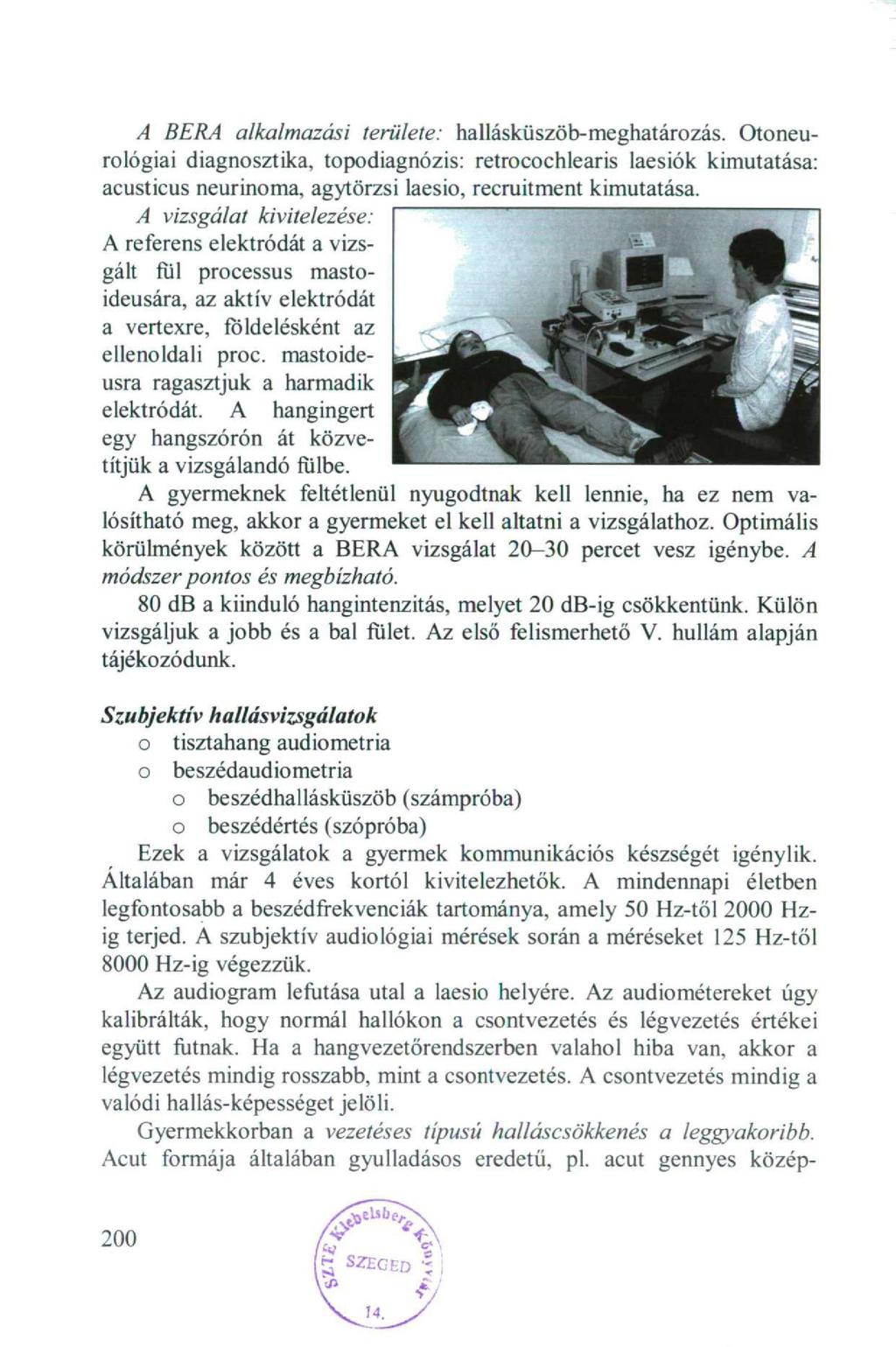 A BERA alkalmazási területe: hallásküszöb-meghatározás. Otoneurológiai diagnosztika, topodiagnózis: retrocochlearis laesiók kimutatása: acusticus neurinoma, agytörzsi laesio, recruitment kimutatása.