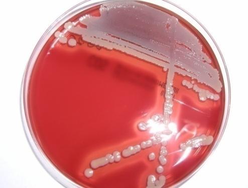 Staphylococcus aureus, MRSA Felső légutak kolonizálja (20%) Fertőzések: bőr, sebfertőzés, endocarditis, osteomyelitis, szeptikus artritis, shunt, stb.