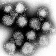 H1N1 influenza!