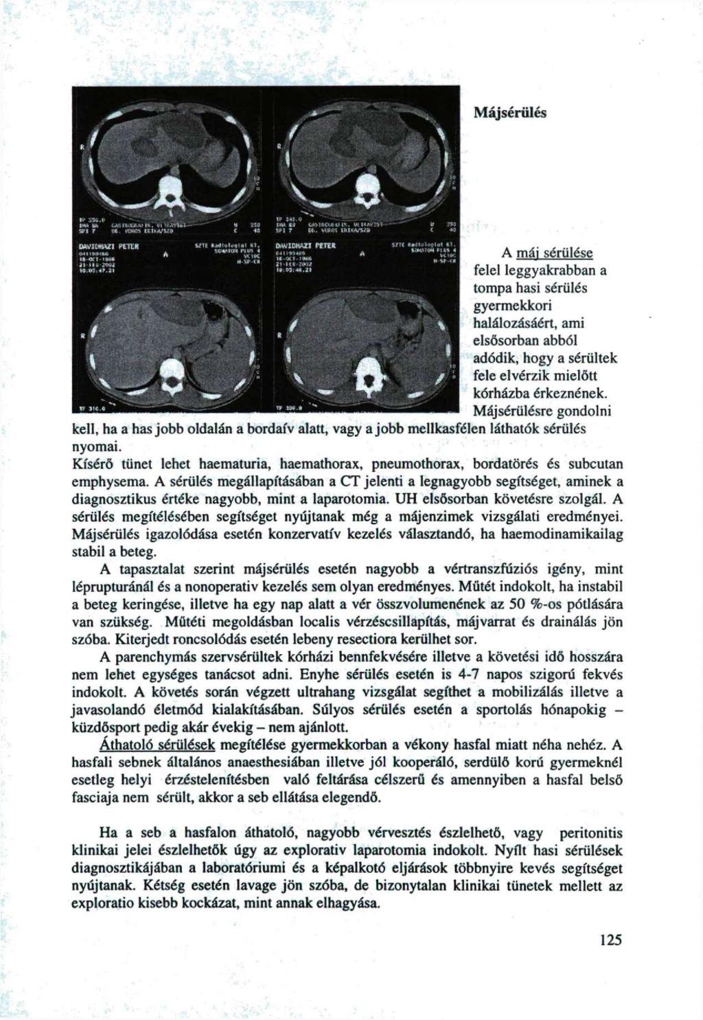 Májsérülés A ( J V XH.» V r JBU UrtUJC**»». W tjqrflw-oí «QK» ClKVU» SAVHAZ PtTtK Ult / /* N na t «. ic*m(w BH 4 vi ik M u> ti ir J4».0 iw ii t»i.. tmiicmkim. wnwm su f wjto-.