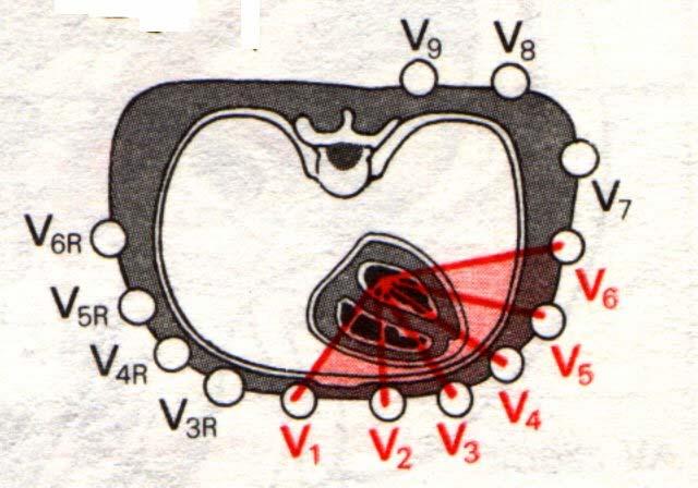EKG-elektródok helyzete 2.