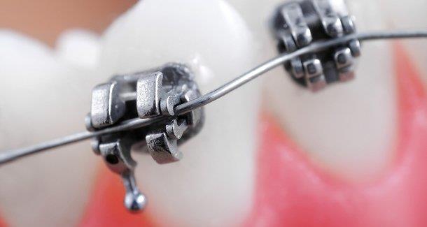 táblázat: Alakemlékező ötvözetek orvostechnikai alkalmazásai Mérés ismertetése A mérés