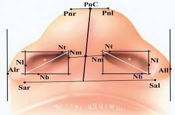 - jobb és bal subalare (Sa r és Sa l [20]), - jobb és bal nostril tip (Nt r és Nt l [50]), - jobb és bal nostril base (Nb r és Nb l [50]), - jobb és bal nostril mediale (Nm r és Nm l [73], - jobb és