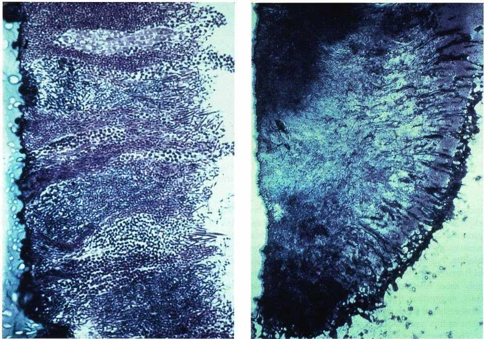 A biofilm struktúrája meggátolja az antibiotikum penetrációját a plakkban ; Aktív elektromosan töltött gátló