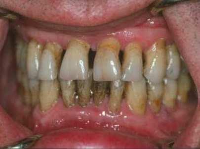 DENTÁLIS