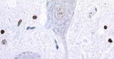 Free radicals DNA damage Down regulated PARP PARP activation Defect in DNA repair Apoptosis Depletion of NAD(+) and ATP Necrosis 2. ábra.