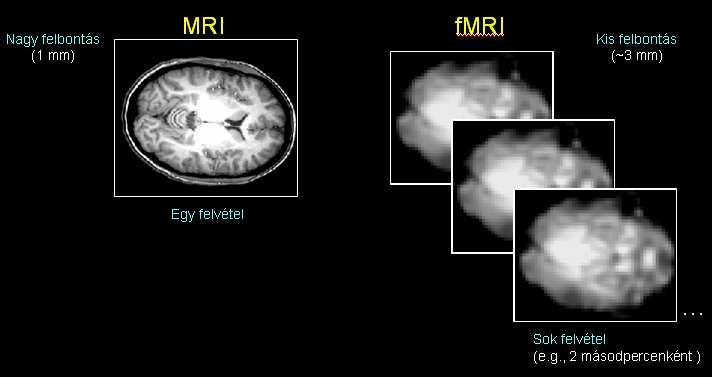 Míg a strukturális (vagy anatómiai/morfológiai) MRI esetében egyetlen nagy felbontású (kb.