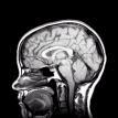 eljárások Mágneses rezonancia imaging (MRI) Radionuclid imaging