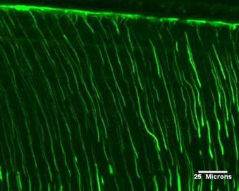 Epifluoreszcens és konfokális