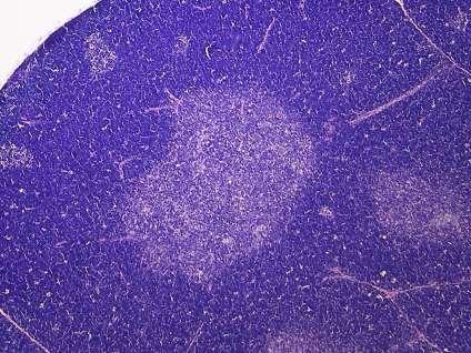 Thymus Normál