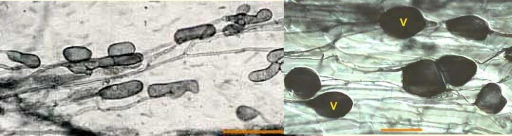 VAM Mikorrhiza-anatómia Veziculumok: Véghifák terminális duzzanatai, nem minden Glomerales