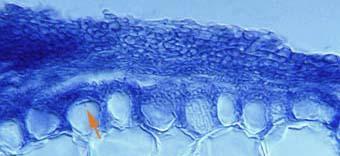 Egyéb ritkább mikorrhizák Monotropoid