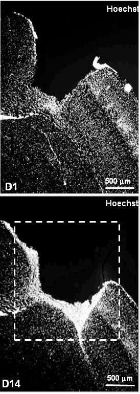 ) progenitors in the fibre tracks