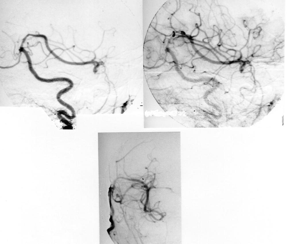 Az anasztomosis