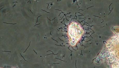 13. ábra: Spirochaeta sp. (fénykép: R. Miseta). 3.3. A gyo ri eleveniszap szezona lis va ltoza sa A győri mintákban a Microthrix parvicella magasabb gyakorisági értékkel volt jellemző a hidegebb időszakban (14.