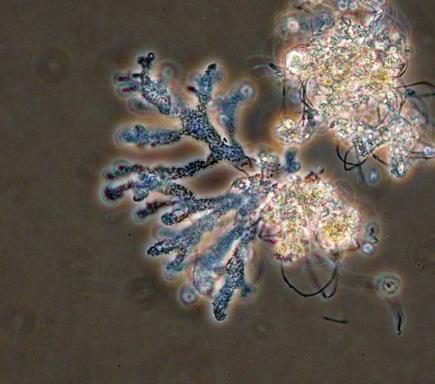 ábra: Microthrix parvicella (fénykép: R. Miseta). 5.