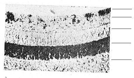 A nitridált acélok szövetszerkezeti mikroszkópos képen, a különböző nitrogén tartalmú rétegek könnyen megkülönböztethetően látszanak, melyet a 10. ábra szemléltet.