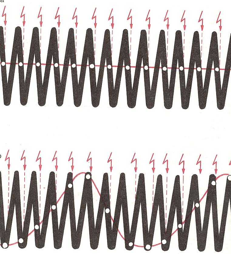 Videostroboscopia Elve: a hangszalagokat a rezgési frekvenciájukhoz képest kissé eltérő, pulzáló