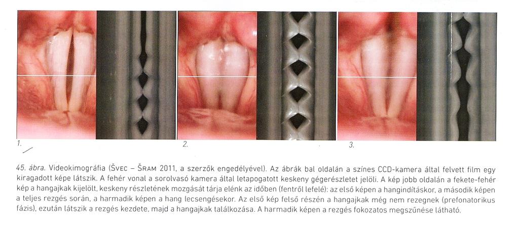 Nagysebességű felvételek - videokimográfia másodpercenként kb.