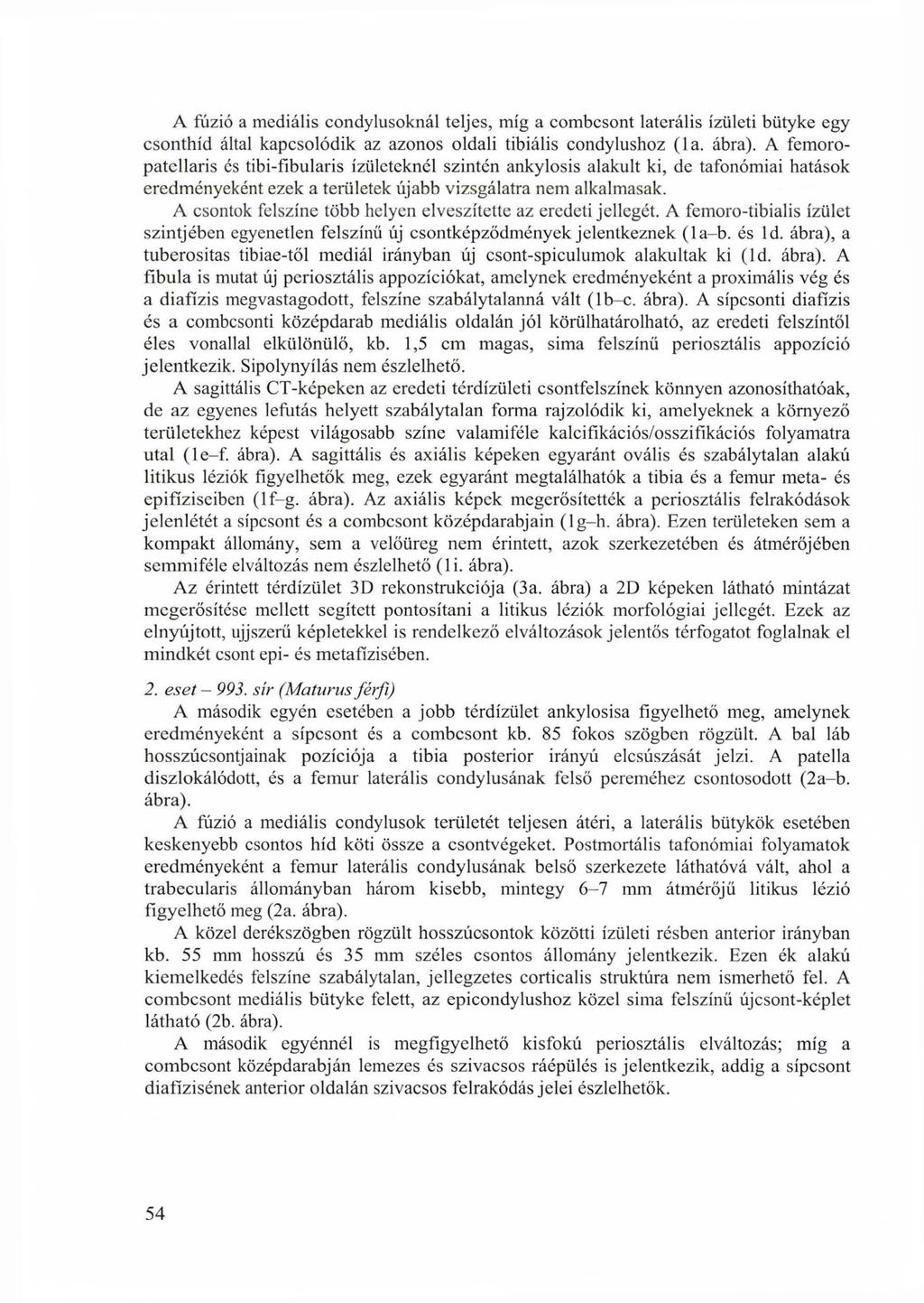 A fúzió a mediális condylusoknál teljes, míg a combcsont laterális ízületi bütyke egy csonthíd által kapcsolódik az azonos oldali tibiális condylushoz (la. ábra).