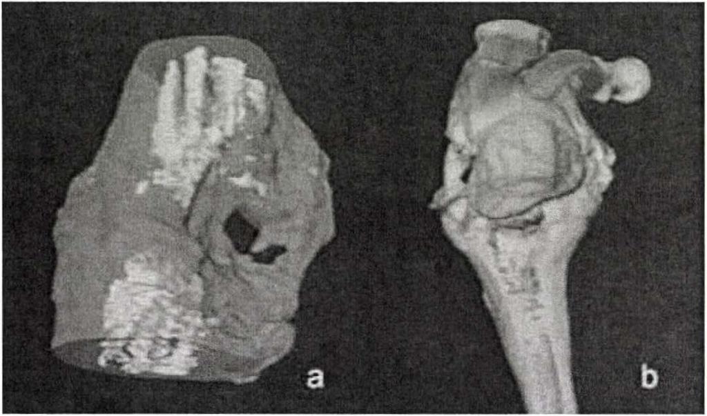 új csont-képződmény szerkezete a CT-képek alapján homogénnek tűnik, trabeculáris elemek nem felismerhetők benne (2f. ábra). A 3D rekonstrukción (3b.