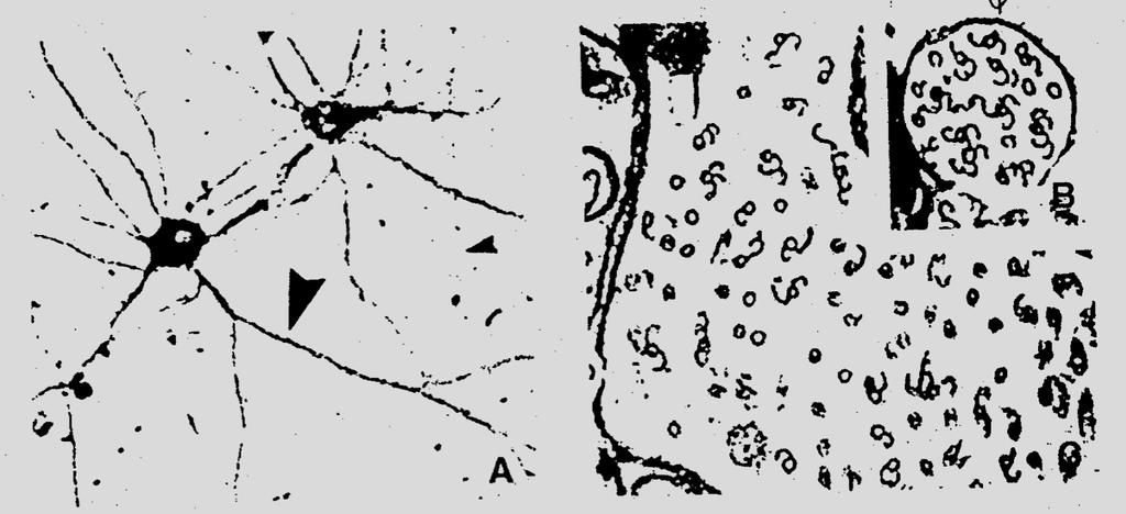 axon