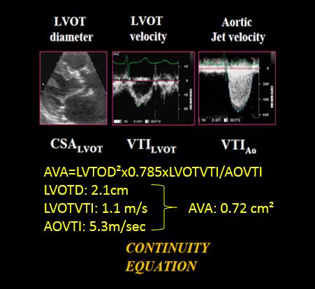 Aorta