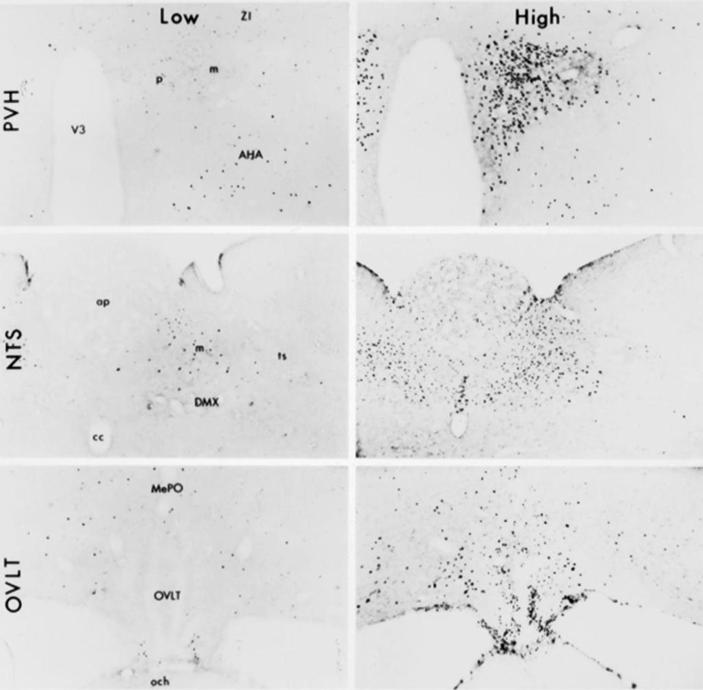 IL-1 hatása a neuronális aktivációra (c-fos expresszió) különböző agyterületeken NTS (nucleus tractus