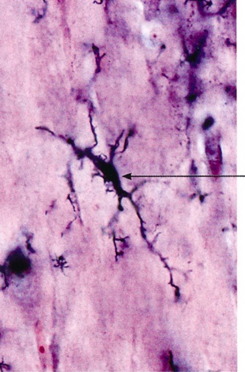 A (Hortega-féle) mikroglia vagy mesoglia A mononukleáris fagocitarendszer tagja Apoptotikus neuronokat fagocitál Kifejez tipikus monocita markereket: CD11b, CD45, MHC II Osztódásra képes Aktiválódás