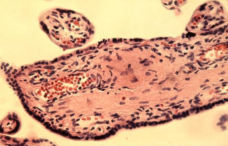 Magzati vér a köldökerek ágaiban Extraembryonalis mesenchyma