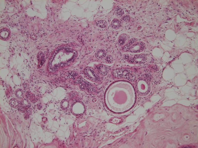 Interlobularis köt szövet lobulus Intralobularis tubulus átmetszetek Intralobularis köt szövet szekréció zsírsejtek A lebenykékben a mirigyek