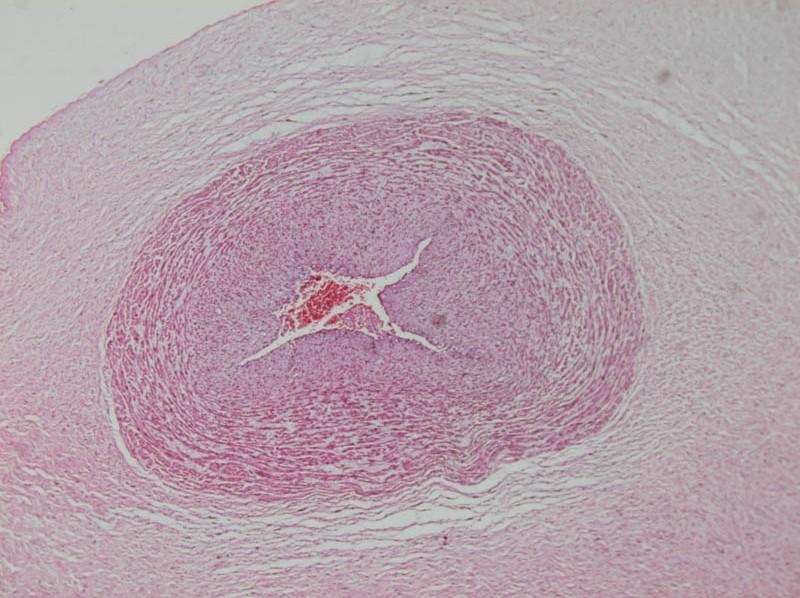 Egyik arteria umbilicalis Wharton-féle kocsonya A köldökzsinór az embryo/fetus és a placenta közötti összeköttetés, melyben Wharton-féle