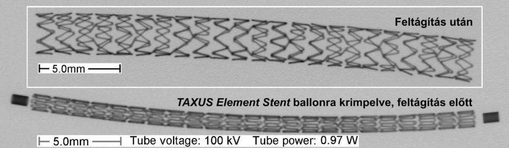 8. ábra. A 2009-re kifejlesztett, Fe-Pt-Cr-Ni ötvözet anyagú TAXUS Element- ( és PROMUS Element-sztent ( röntgenmikroszkópi képe 3.