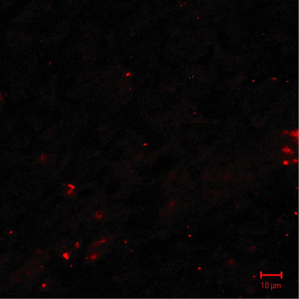 4.4. Az UIC2 gátlás tesztelése in vivo tumor xenograftokban Az antitest és modulátor együttes hatásának in vivo teszteléséhez SCID egerek (20 db egér, 3 független kísérletben) mindkét combja bıre alá