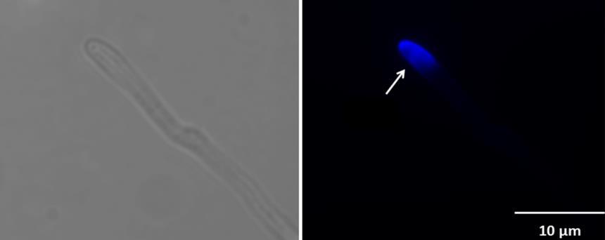 A nyíl a kitinfilamentumok megváltozott elrendeződését jelzi. A bal oldali kép fénymikroszkópos, a jobb oldali kép fluoreszcens mikroszkópos felvétel. 6.5.
