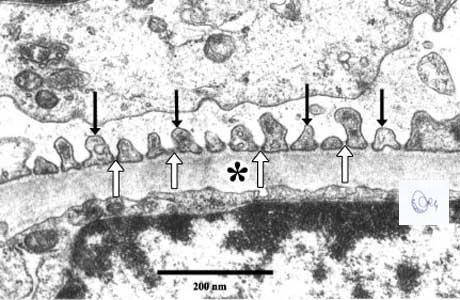 Egészséges vese glomeruláris bazalis membránjának elektronmikroszkópos képe nagy nagyítással.