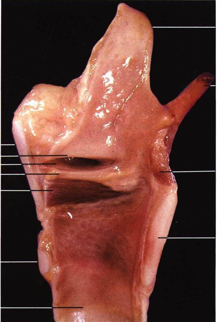 cricothyroideum (Lig.