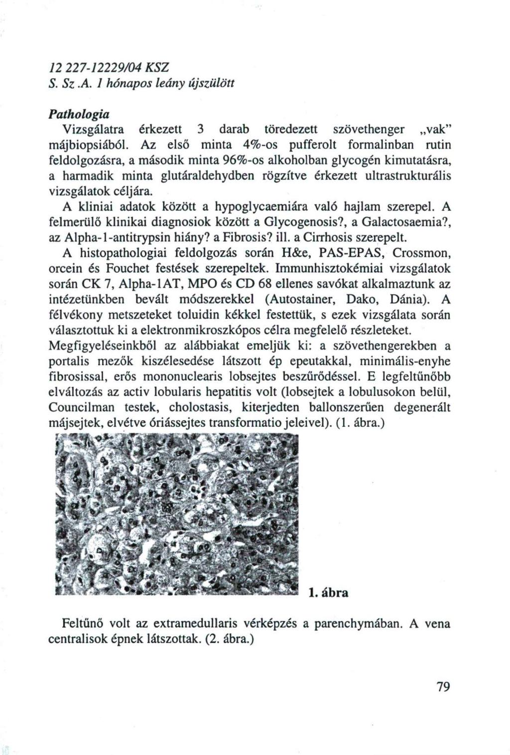 12 227-12229/04 KSZ S. Sz.A. 1 hónapos leány újszülött Pathologia Vizsgálatra érkezett 3 darab töredezett szövethenger vak" májbiopsiából.